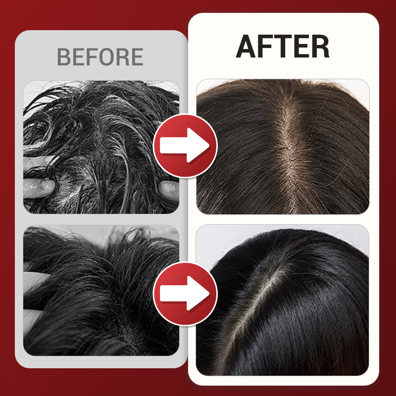 Multi-function Head Massage Comb